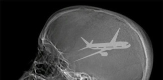 Aviator’s Brain Scan
